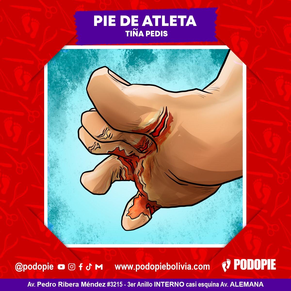 PIE DE ATLETA