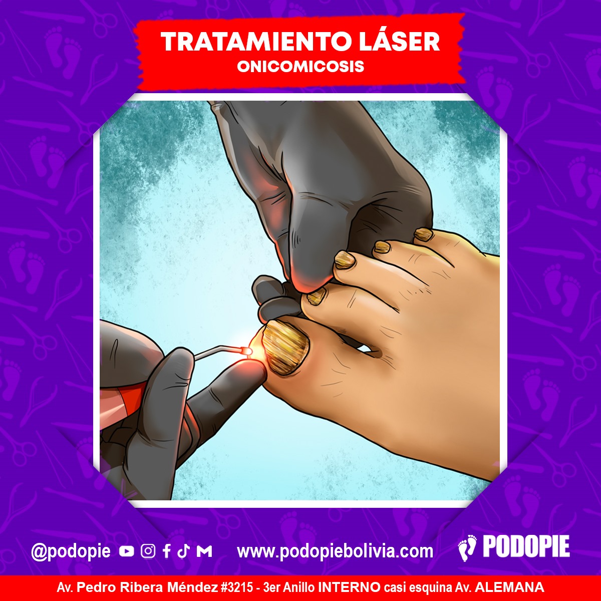 TRATAMIENTO LASER