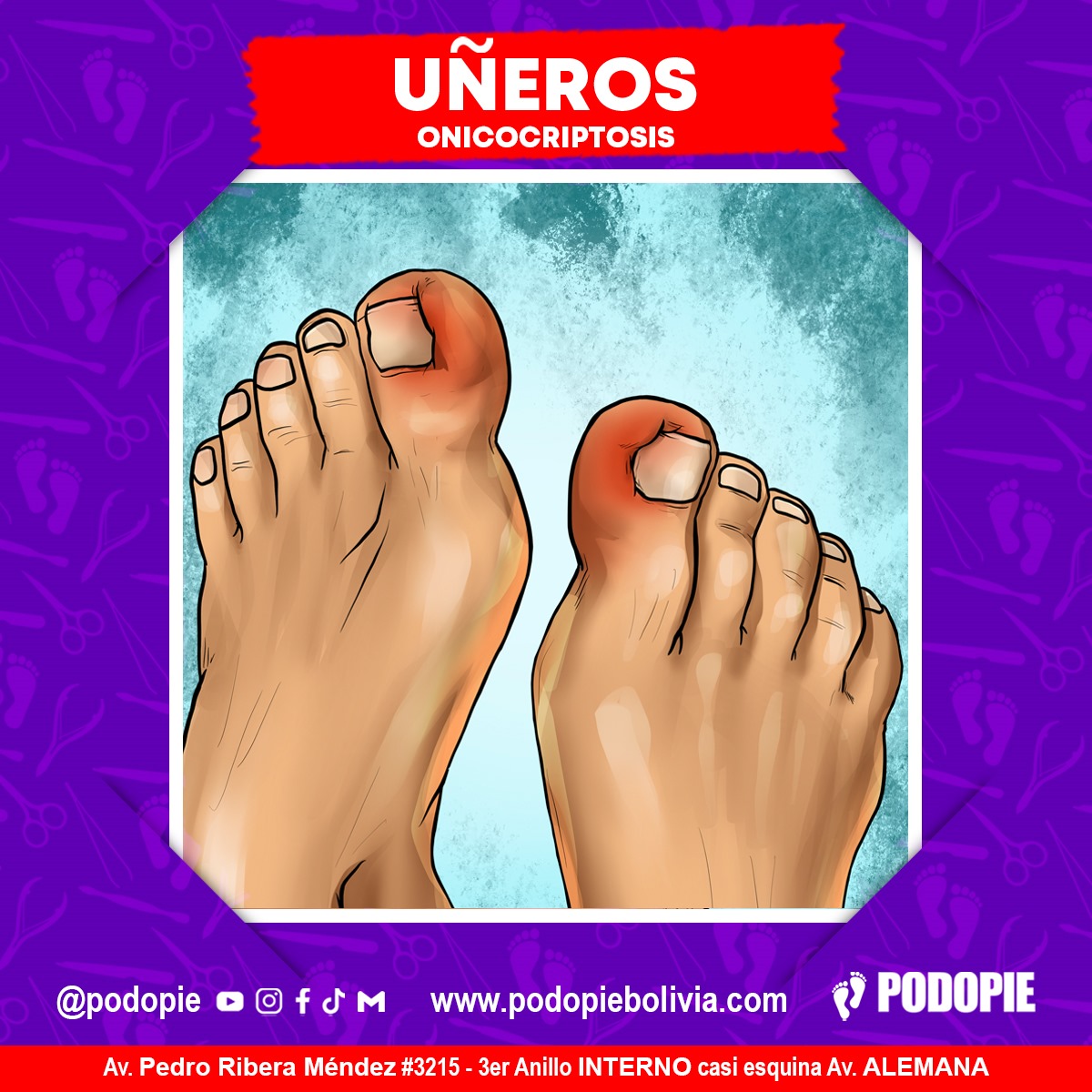 1. UÑEROS