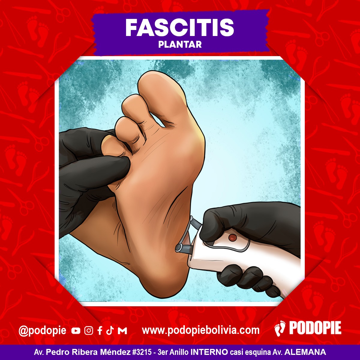15. FACITIS PLANTAR