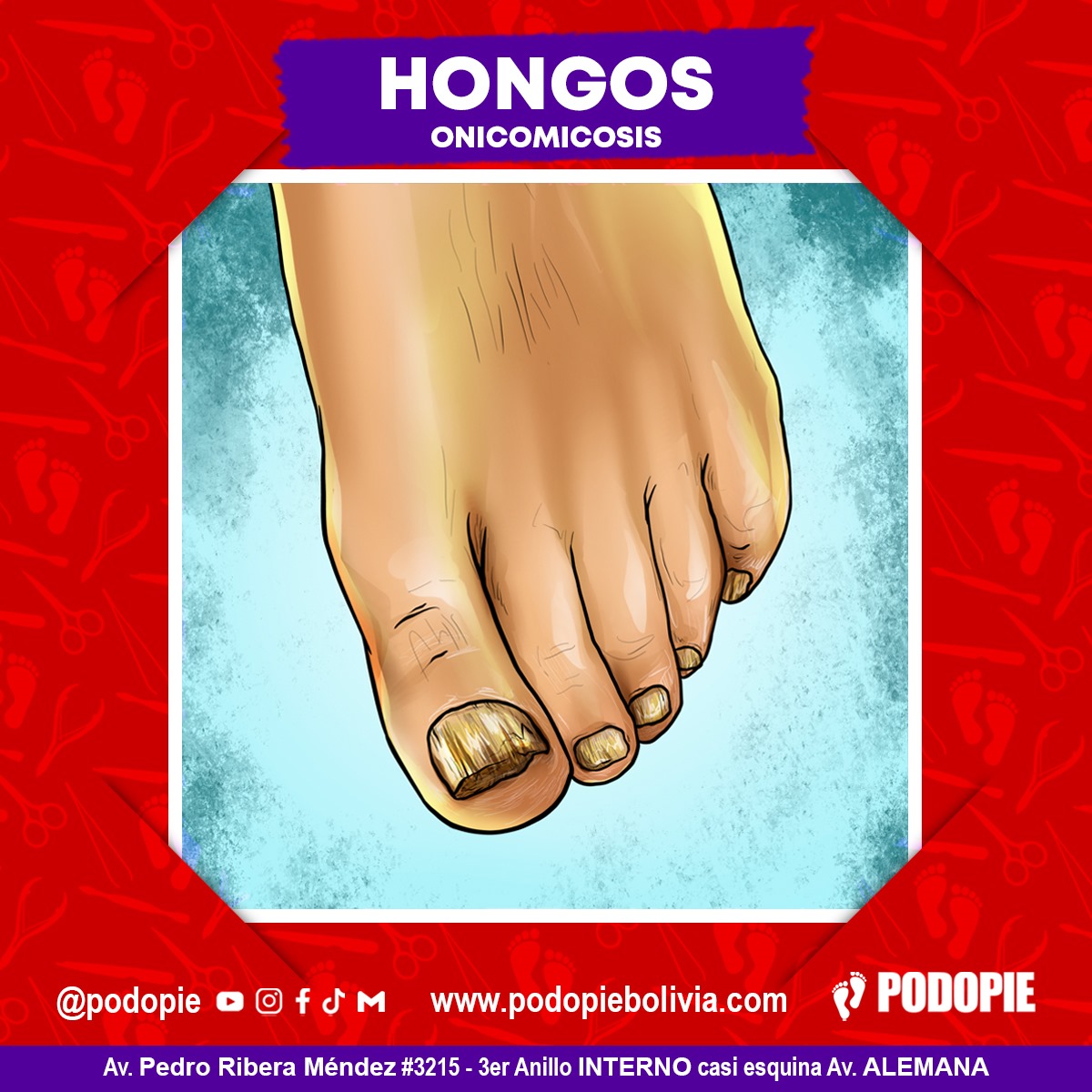 3. HONGOS