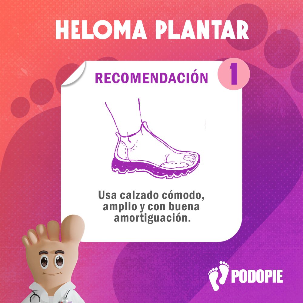 HELOMA PLANTAR RECOMENDACIONES 1 copia