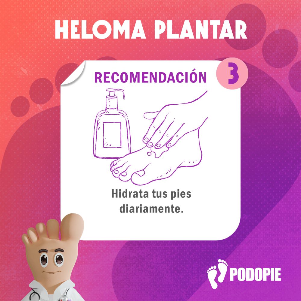 HELOMA PLANTAR RECOMENDACIONES 3 copia