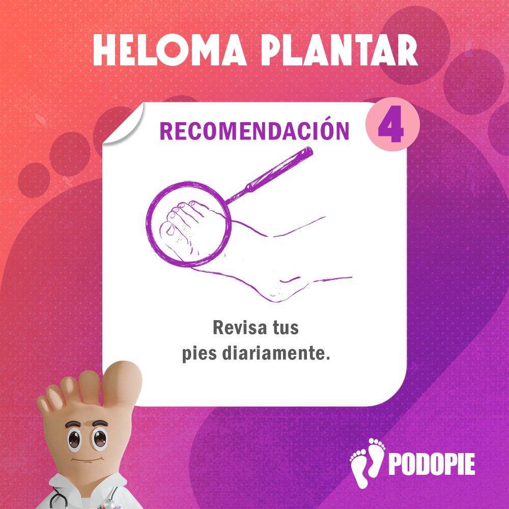 HELOMA PLANTAR RECOMENDACIONES 4 copia