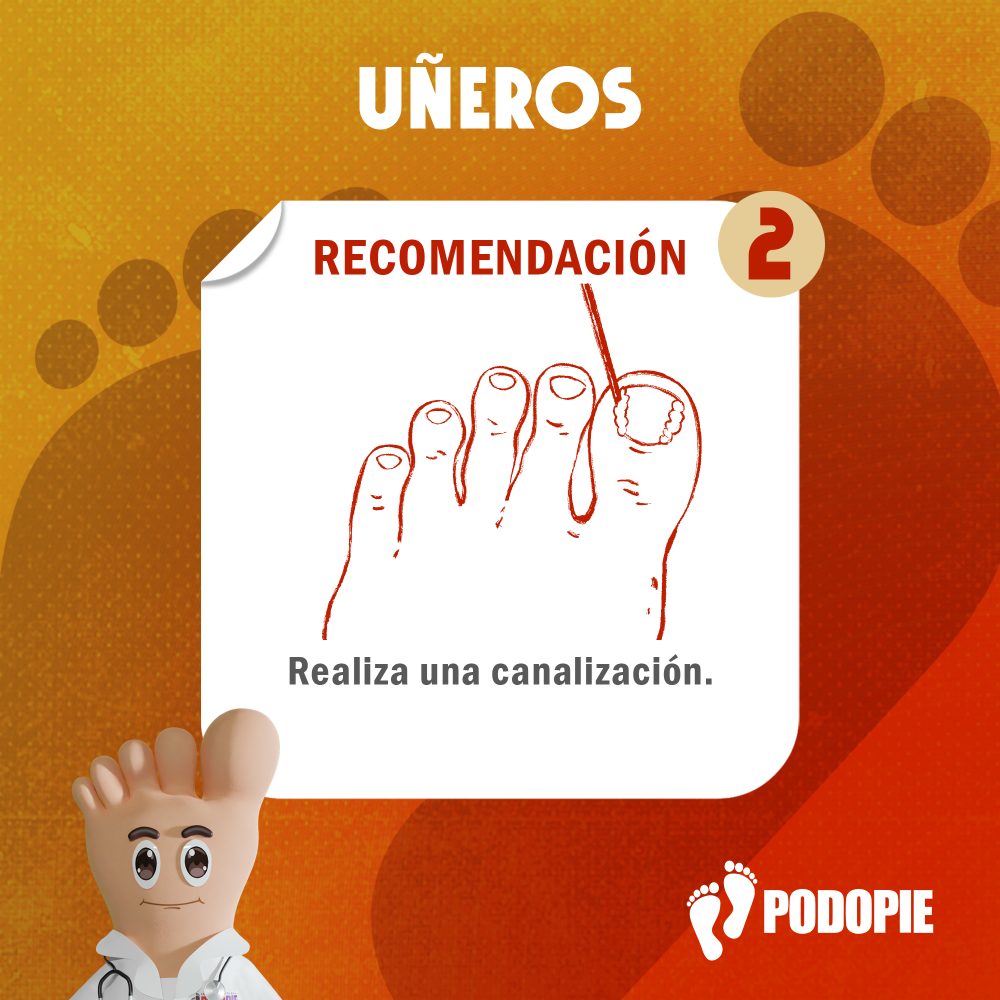 UÑEROS RECOMENDACIONES 2 copia